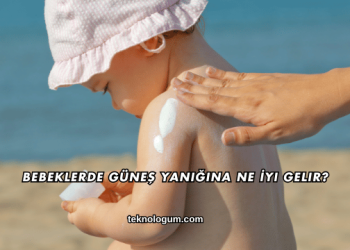 Bebeklerde Güneş Yanığına Ne İyi Gelir?