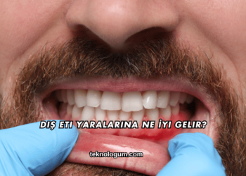 Diş Eti Yaralarına Ne İyi Gelir?